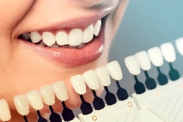 High-quality dental crowns and restorative dentistry services in Brooklyn.