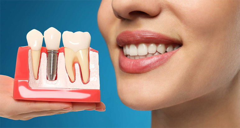 Patient smiling after successful cosmetic dental treatment.