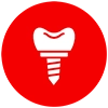 Dental implant consultation with a specialist discussing tooth replacement options