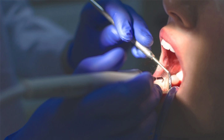 Brooklyn dentist examining a patient's tooth before root canal treatment