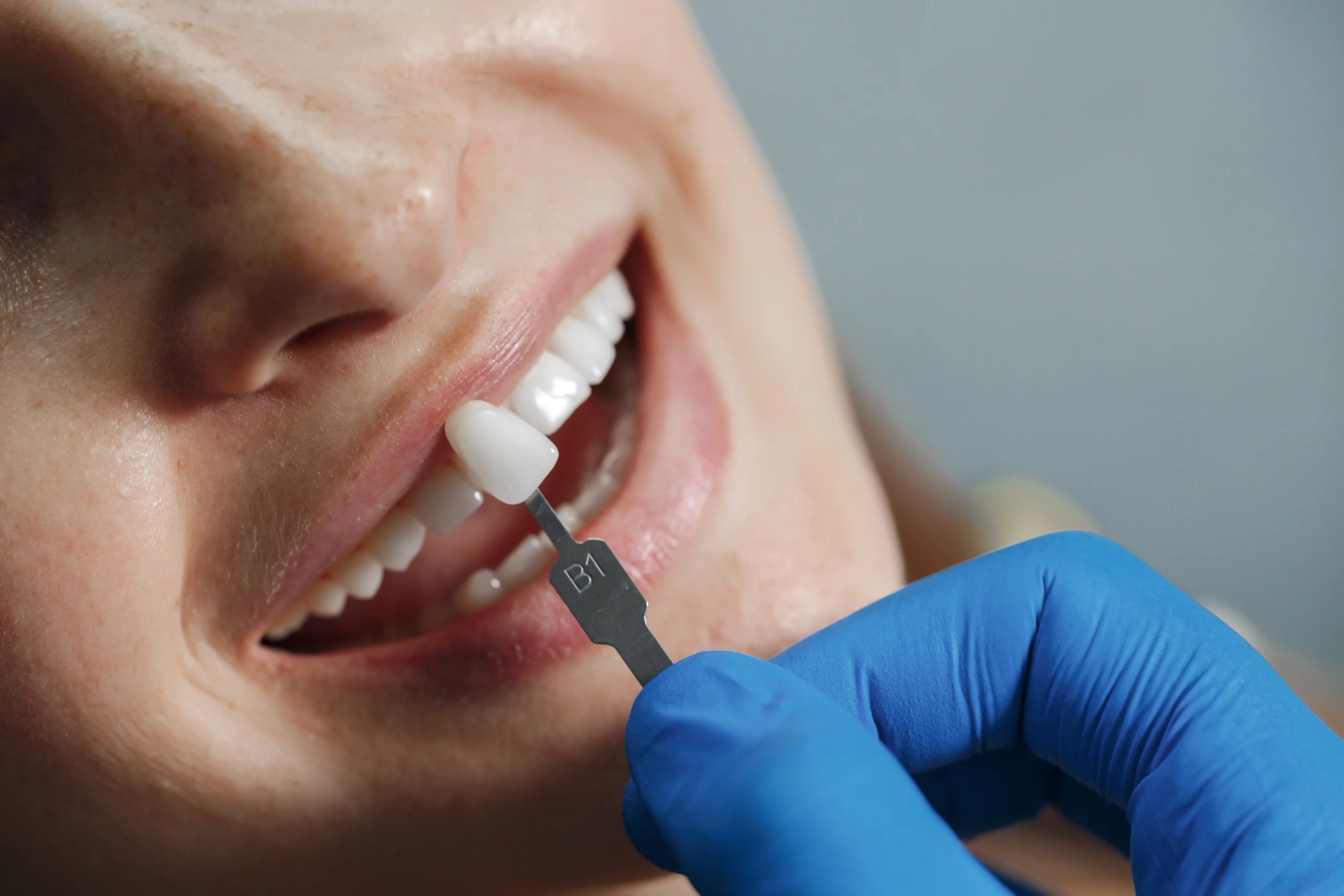 How Much Do Dental Implants Cost in Brooklyn Without Insurance?